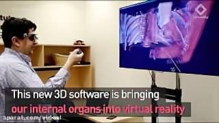 اندام‌های داخلی در واقعیت مجازی EchoPixels True 3D soft